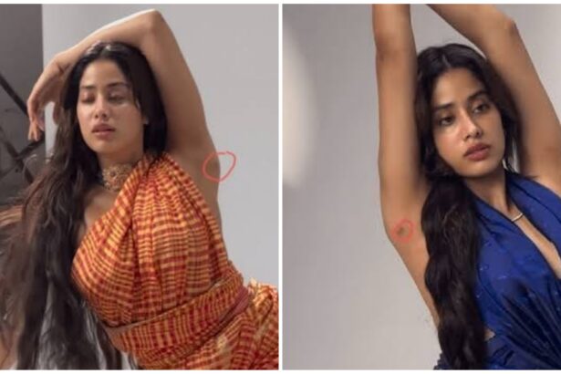 Janhvi Kapoor Surgery