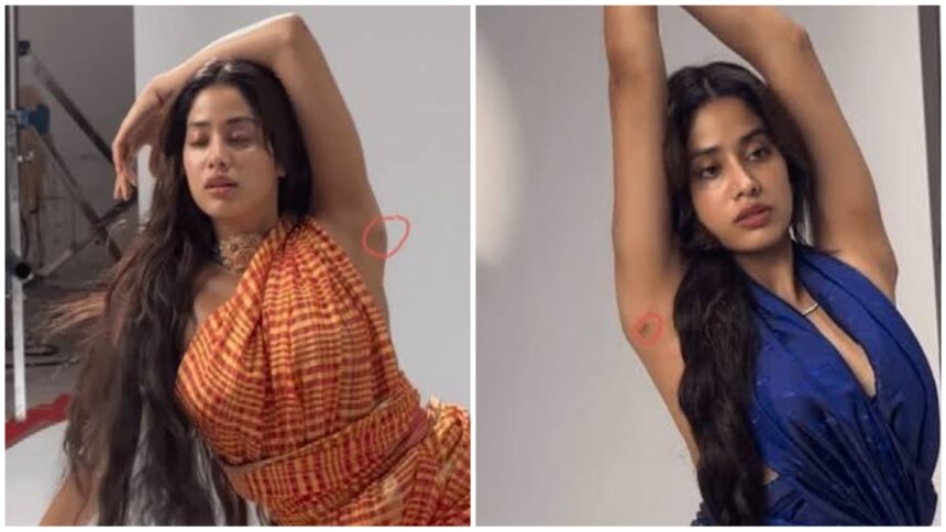 Janhvi Kapoor Surgery